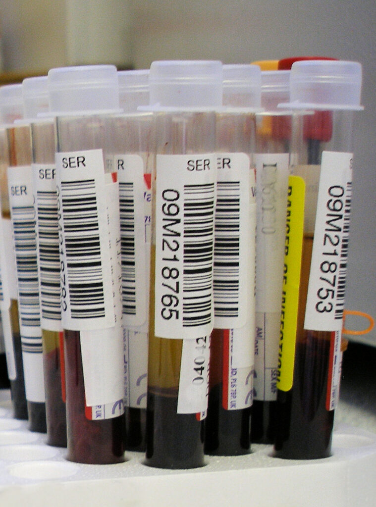 Tubos de muestras de sangre para análisis clínico