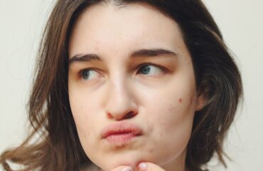 Mujer observando la piel del rostro con acné, imagen educativa para artículo de Ayurveda
