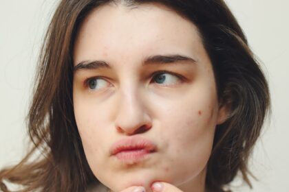 Acné desde Ayurveda – imagen destacada Mujer observando la piel del rostro con acné, imagen educativa para artículo de Ayurveda