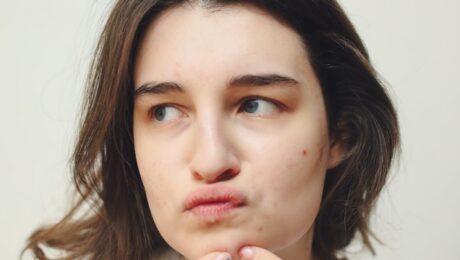 Acné desde Ayurveda – imagen destacada Mujer observando la piel del rostro con acné, imagen educativa para artículo de Ayurveda