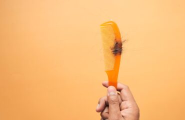 Cabello caído sobre un peine como imagen educativa para artículo sobre calvicie y Ayurveda