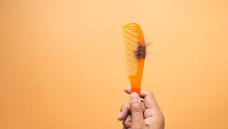 Cabello caído sobre un peine como imagen educativa para artículo sobre calvicie y Ayurveda
